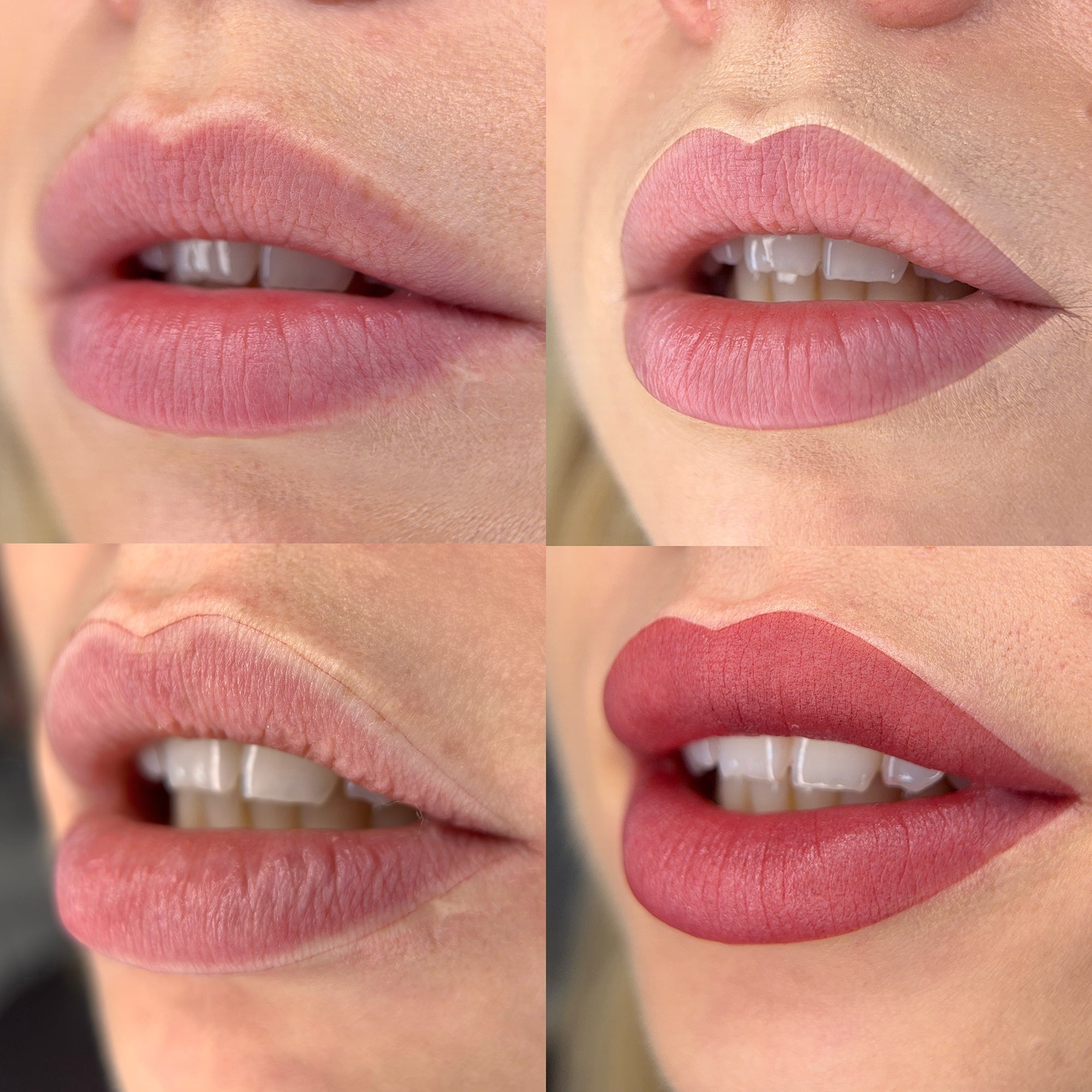 Vergleich frischer Nude-Permanent-Make-up-Lippen direkt nach der PMU-Behandlung mit unterschiedlichen Abheilzielen und Gewebereaktionen