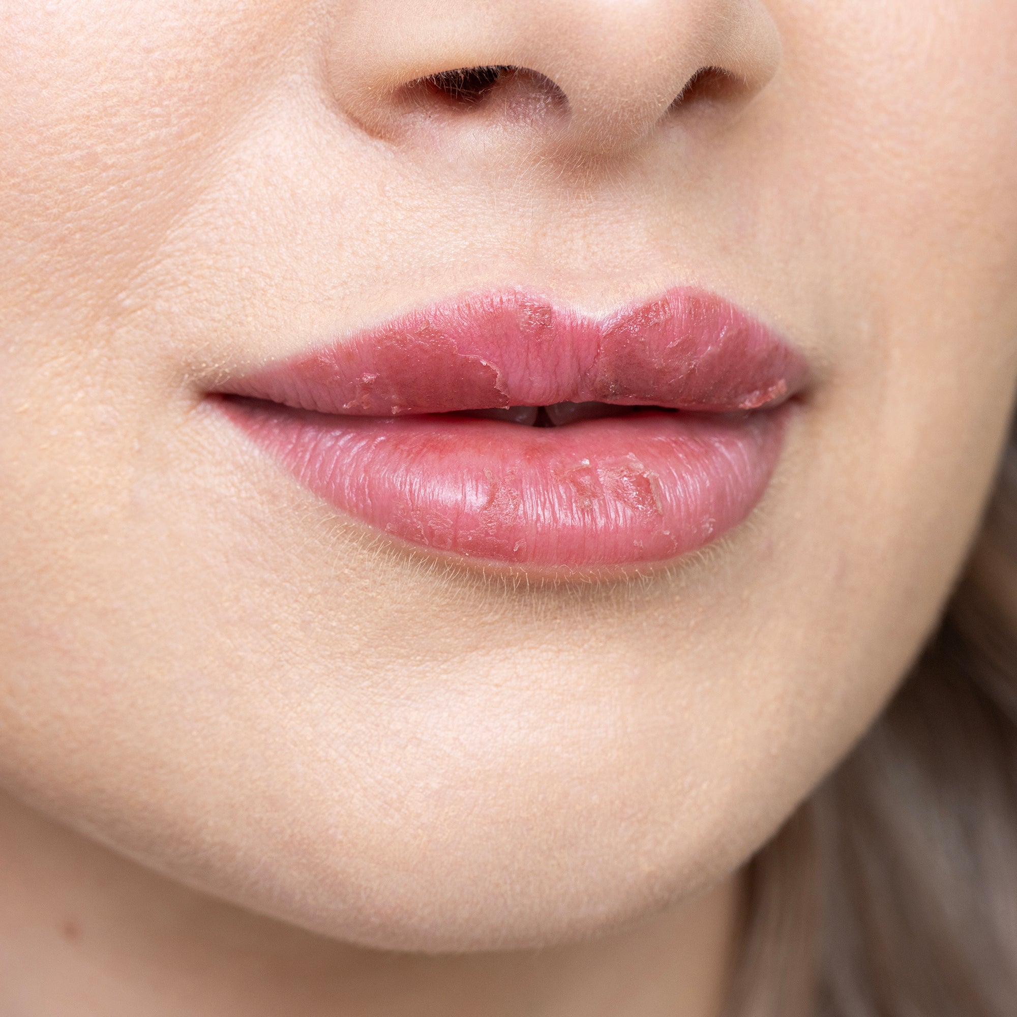 Abheilende Lippen nach Lip-Blush-Permanent-Make-up